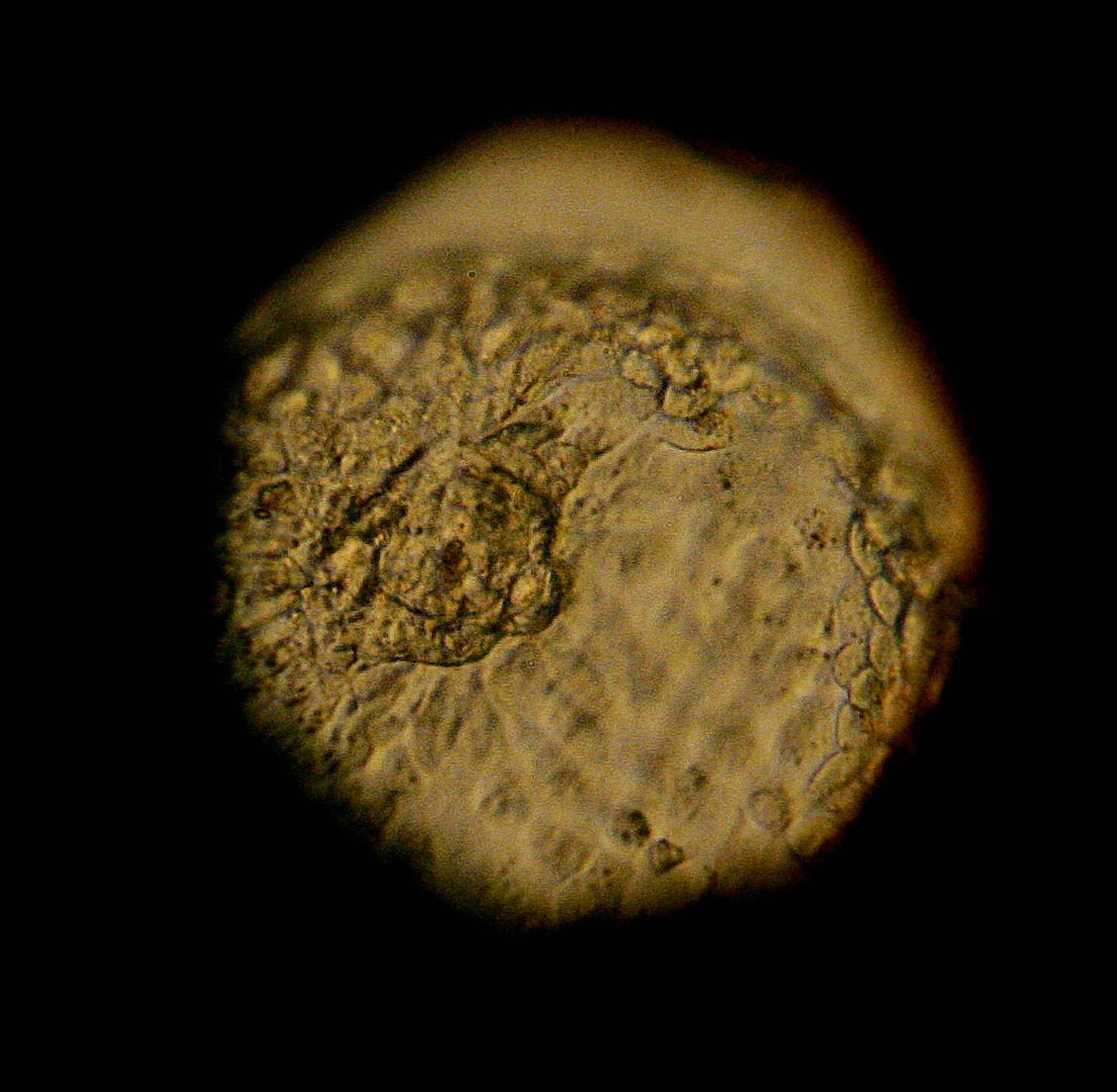 A donated human embryo is seen through a microscope at the La Jolla IVF Clinic February 28, 2007 in La Jolla, California. The clinic accepts donated embryos from around the country through The Stem Cell resource which are then given to stem cell research labs for research.