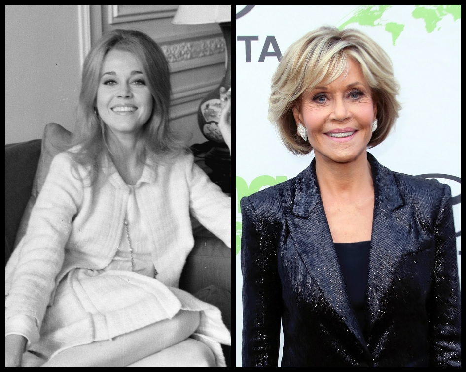Even in the past, the American icon has been very open about why she got work done on her eyes and jawline (Getty Images)