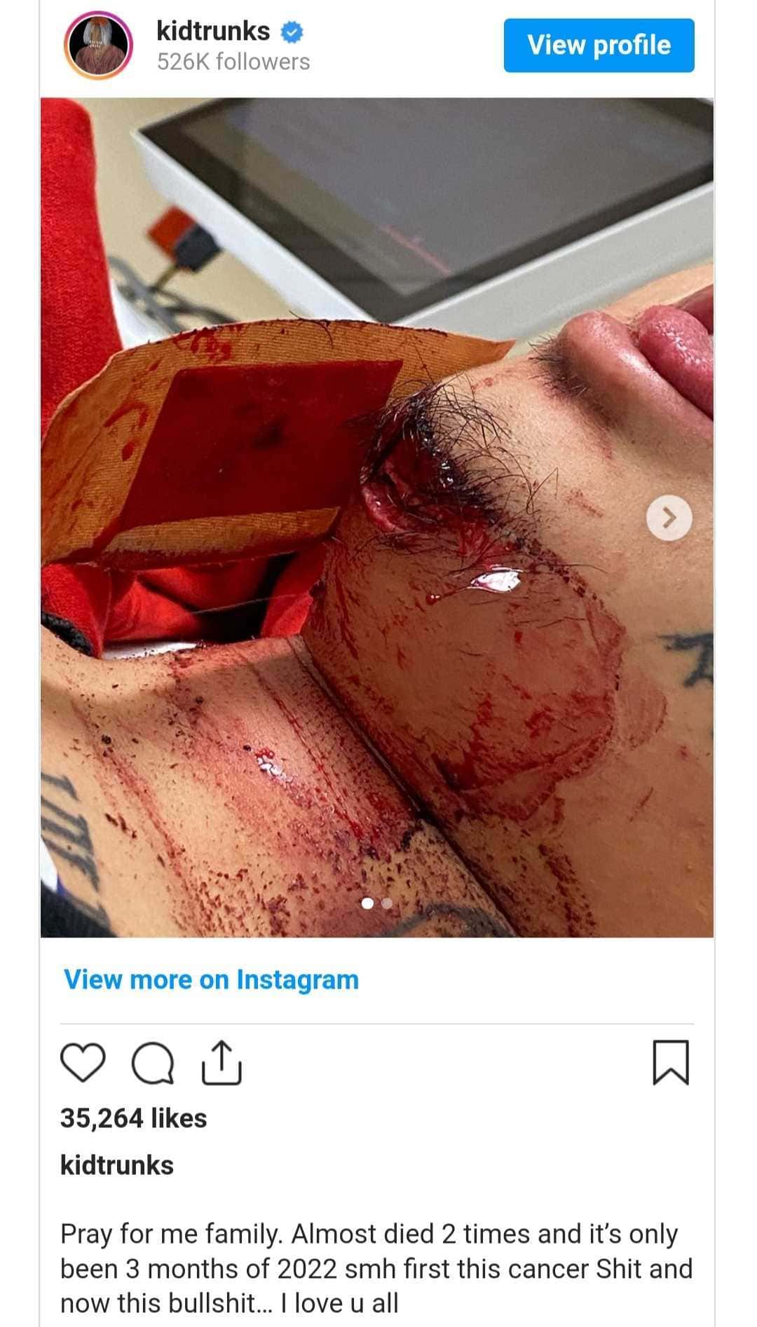 Kid Trunks shooting Rapper shares pics with deep gash across chin MEAWW